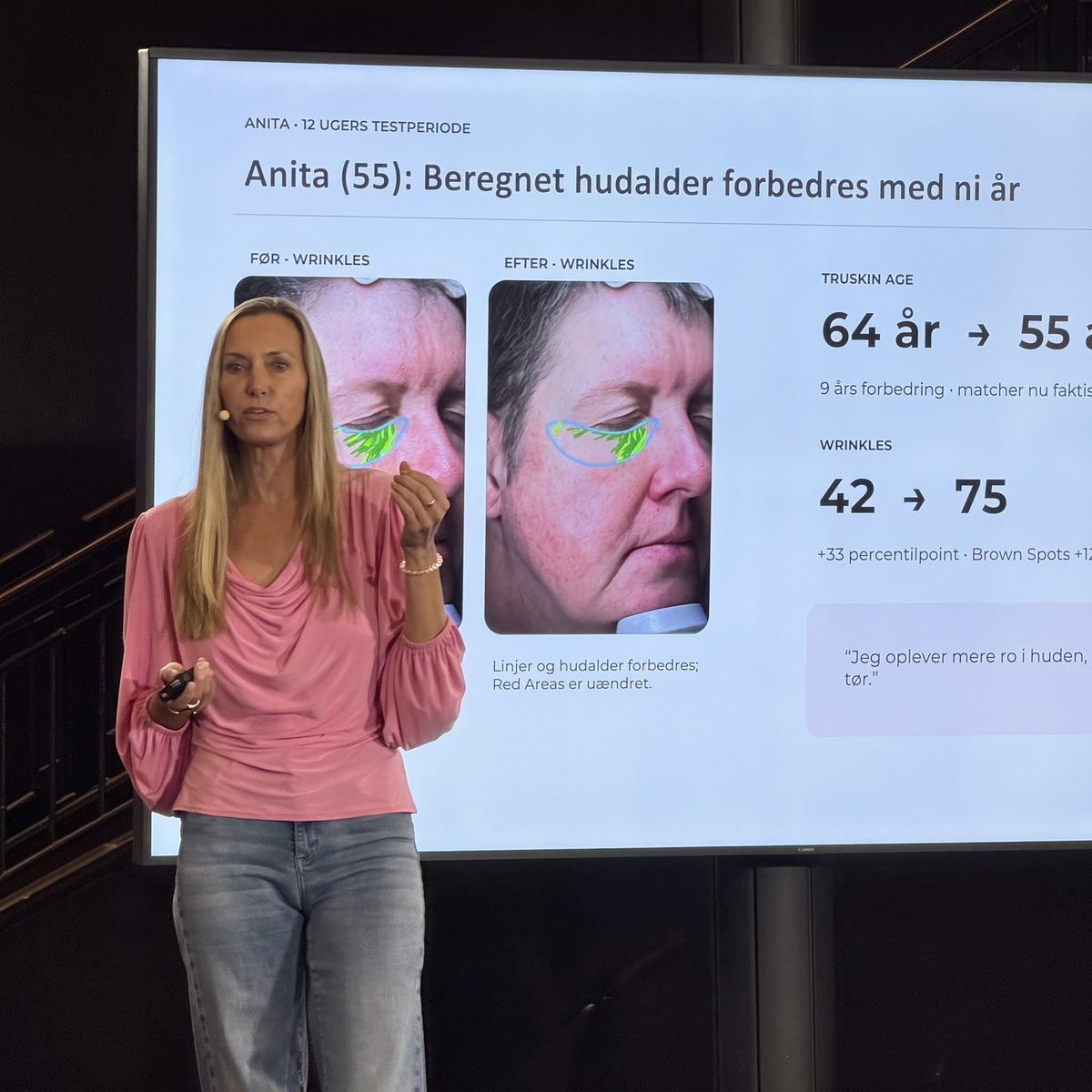 Carolina holder oplæg om hvordan Green Goddess har gennemført en hudanalyse med collagenbrugere